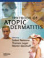 Textbook of atopic dermatitis