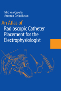 An atlas of radioscopic catheter placement for the electrophysiologist