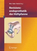 Revisionsendoprothetik der hüftpfanne