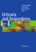 Urticaria and angioedema