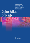 Color atlas of nails