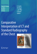 Comparative Interpretation of CT and standard radiography of the chest