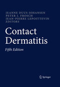 Contact dermatitis