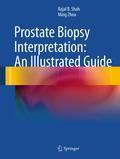 Prostate biopsy interpretation: an illustrated guide