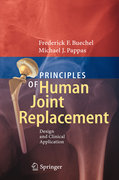 Principles of human joint replacement: design and clinical application