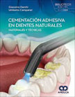 Cementación Adhesiva en Dientes Naturales: Materiales y Técnicas