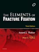 Elements of Fracture Fixation