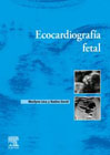 Ecocardiografía fetal