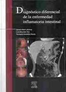 Diagnóstico diferencial de la enfermedad inflamatoria intestinal