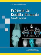 Prótesis de rodilla primaria: estado actual