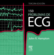 150 problemas de ECG