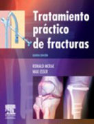 Tratamiento práctico de fracturas