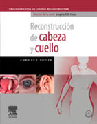 Reconstrucción de cabeza y cuello