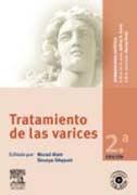 Tratamiento de las varices