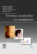 Técnicas avanzadas en rinoplastia