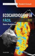 Ecocardiografía fácil