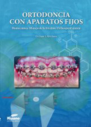 Ortodoncia con aparatos fijos: Biomecánica. Manejo de la fricción. Orthospeed System