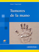 Tumores de la mano