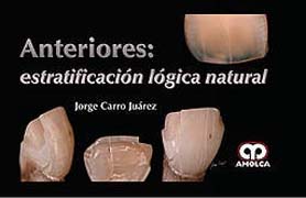 Anteriores: Estratificación Lógica Natural