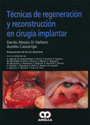 Técnicas de Regeneración y Reconstrucción en Cirugía Implantar